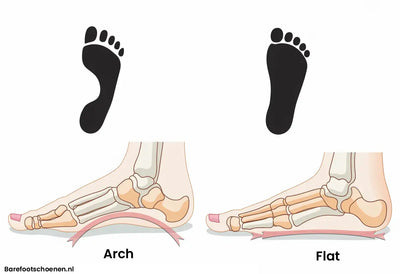 HELP! Ik heb platvoeten! (Pes Planus)