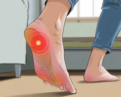 Inlegzolen Kopen? Waarom Steunzolen Niet Werken (En Wat Wél)
